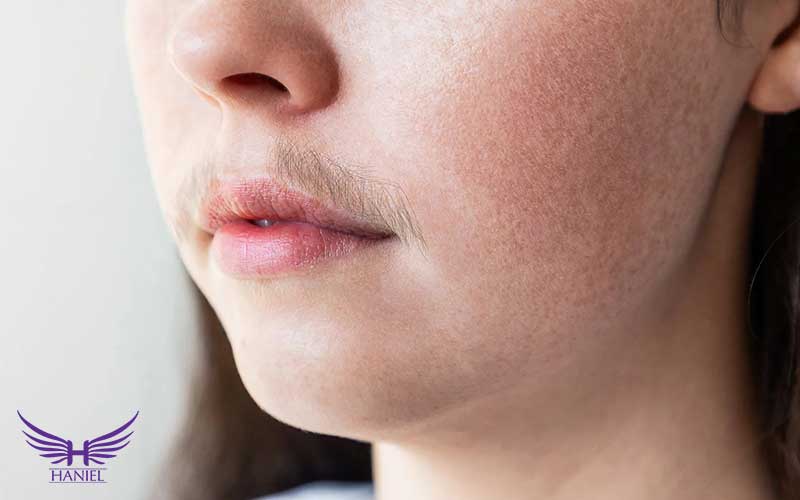 روش-های-درمان-مردمویی